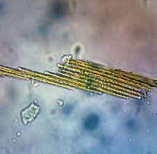 Too Much of a Good Thing: How Fertilizers Are Unraveling the Web of Life